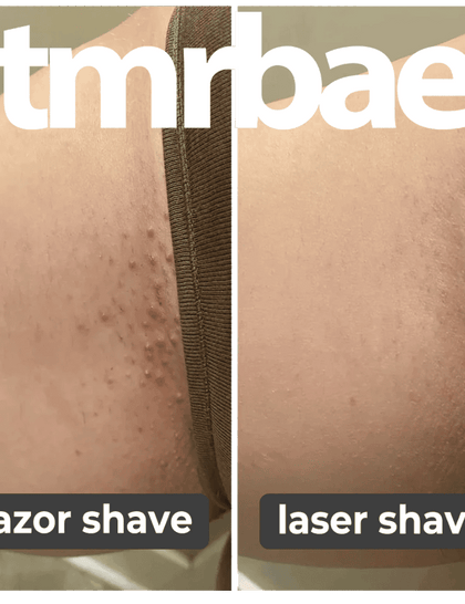 Tmrbae™ NAKED IPL hair removal Gen 2 (990,000 xung)