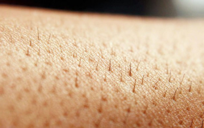 10 điều cần biết trước khi triệt lông vùng bikini