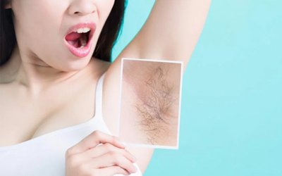 Triệt lông “vĩnh viễn” hay “vĩnh viễn” triệt lông