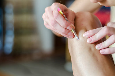 TÌNH TRẠNG VIÊM LỖ CHÂN LÔNG VÀ CÁCH KHẮC PHỤC