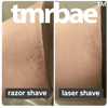 Tmrbae™ NAKED IPL hair removal Gen 2 (990,000 xung)