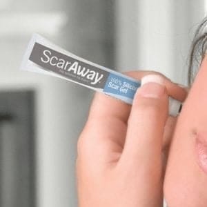 Gel trị sẹo Scaraway (10g)